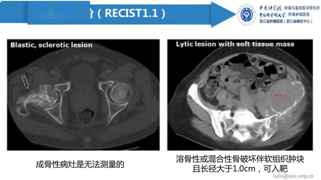 实体瘤最新研究进展与治疗策略综述