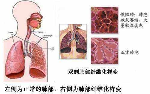 离夏惜柚子